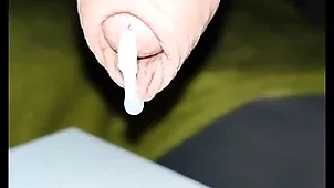 Milking prostate