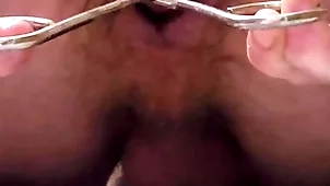 Workaday calabash enema increased by anal distention