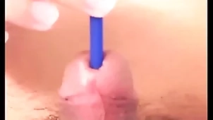 009 load of shit torc plus infection gone